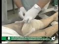 Autopsia: Vivir con la muerte