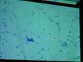Spermatozoa