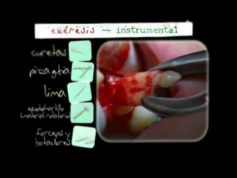 cirugía dental - Una de las claves para que los procedimientos en Cirugía Bucal se desarrollen de una forma práctica y eficiente es disponer del instrumental necesario para c...