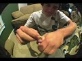 chad rips toenail off chad rips toenail off