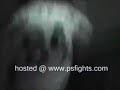 Quick Beatdown at a Party Quick Beatdown at a Party