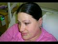 The Cesarean Birth Of Saskia Alice