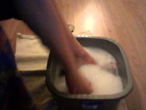 how to get rid of dead skin on feet