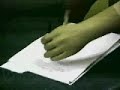 MYOELECTRIC PROSTHESES WITH SENSORIAL FEEDBACK