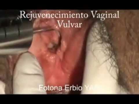 vajina