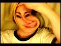 Chris Crocker With a new Look AKA THE Elephant Man