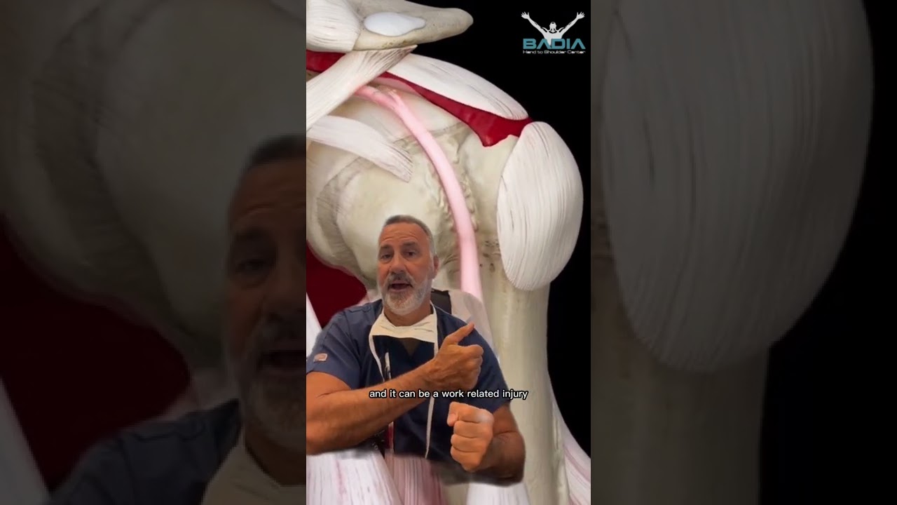 Orthopedic surgeon explains : proximal biceps rupture using 3D4Medical animation