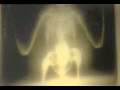 Assistir ao v�deo