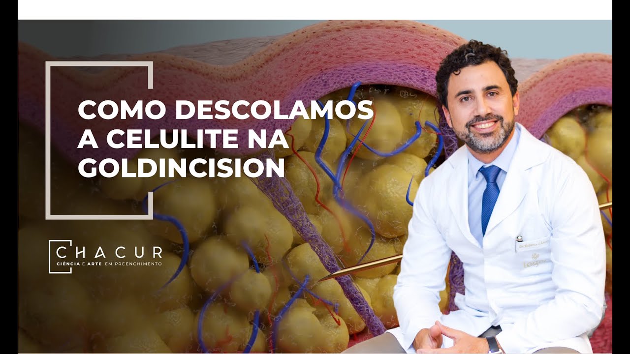 Goldincision: uma abordagem multifatorial no tratamento da celulite ...