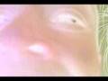 videos de Negative Fratzen