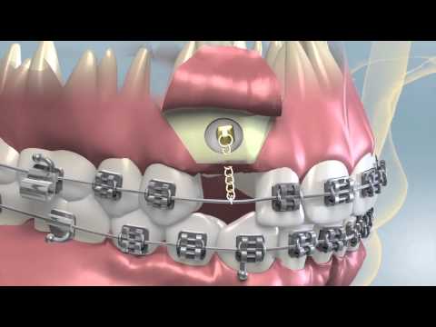 how to become orthodontist