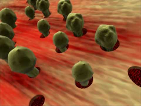 how to treat aplastic anemia