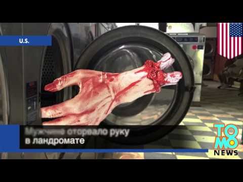 Травматическая ампутация конечностей – Отрывы частей тела
