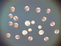 fission reaction atomic bomb fission reaction atomic bomb