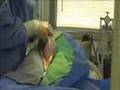 Mastiff - English Mastiff C-Section - dog cesarean surgery