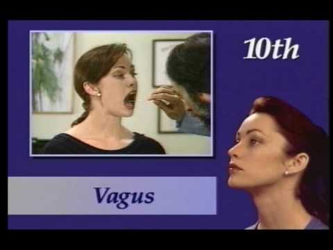 how to assess cranial nerves