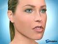 Lower Jaw Set-Back Surgery
