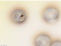 mefloquine 15 min (2) Mefloquine