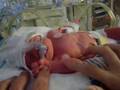 videos de Savannah in the NICU