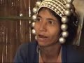 Akha Vaccinations and Miscarriages