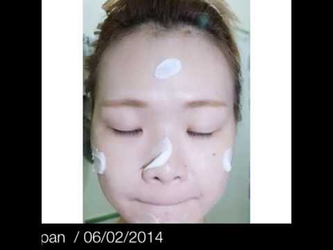 how to control acne on test e