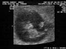 Pre-Bebe Rojas Santos 12 semanas saludando