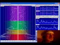 Brain Coherence Measured with Dan Winter