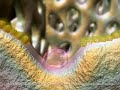 Osteoporosis