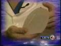 breast augmentation 411