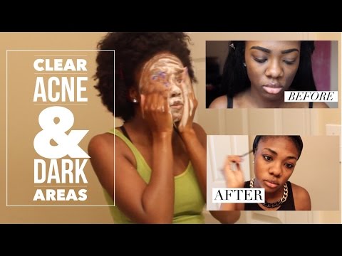 how to care black skin