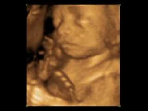 nによるUnbornBAはBeingAブンブンAn親Being/ライフのAntiAbortionビデオPSを止めます。A