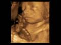 The Unborn Baby Never Stops Being A Human Being / Pro-Life Anti-Abortion Video PSA