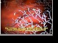 Thrush Treatment http://www.uhomeopath.com yeast infection cure Thrush Treatment http://www.uhomeopath.com yeast infection cure