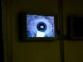 My Lasik Surgery pt.2