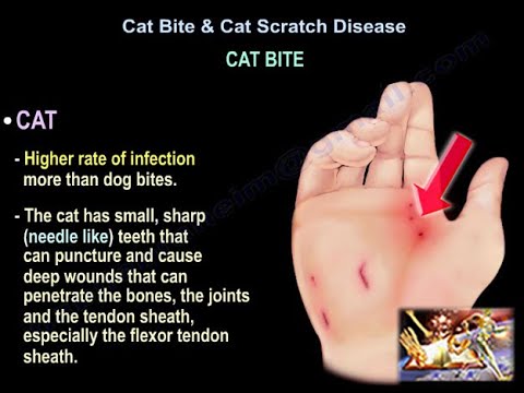 Cat Bite & Cat Scratch Disease - Everything You Need To Know - Dr. Nabil Ebraheim