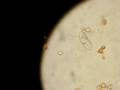 paramecium multimicronucleatum vs yeast - pt1