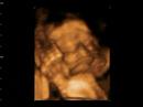 Elise Tarynn Krzak -- 28 weeks ultra sound