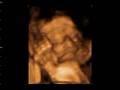 Elise Tarynn Krzak -- 28 weeks ultra sound
