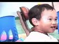 fragile x syndrome