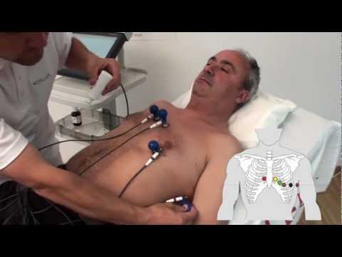how to attach ecg electrodes