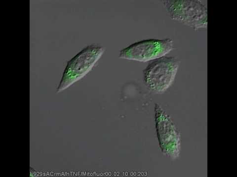 TNF-induced necrotic L929 cells – Morphology & MMP overlay