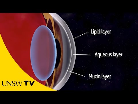 how to cure sore eyes