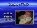 Dr. Jay Jensen explains TMJ Dr. Jay Jensen explains TMJ