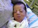 Jack without his cannula