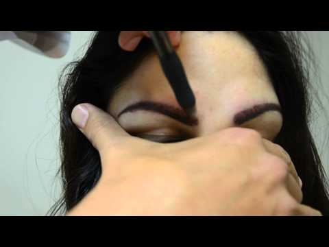 how to transplant eyebrows