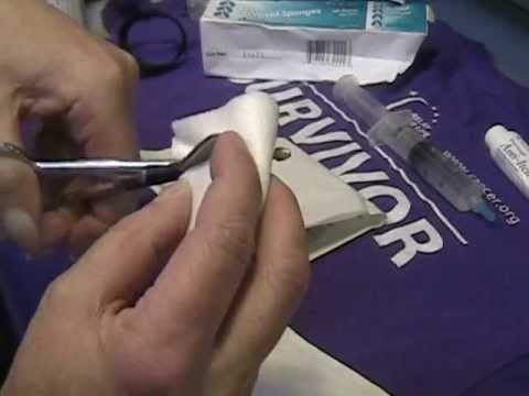 how to remove ng feeding tube