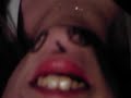 Chin Person