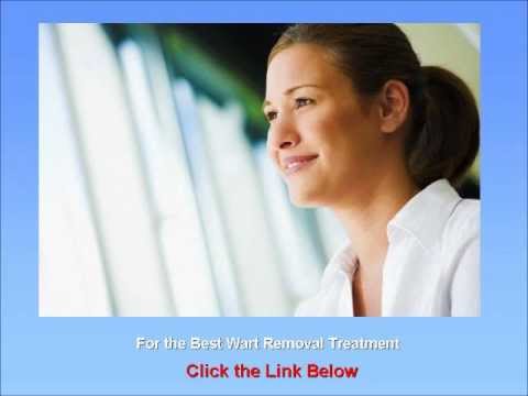 how to control warts