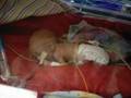 My micro-preemie 13 ounces!!!