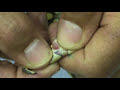 Sexing Baby Ball Pythons - part 1 Sexing Baby Ball Pythons - part 1